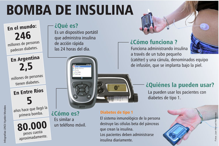 Bomba de insulina.cdr