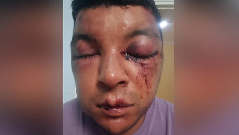 Joven denunció que fue víctima de un violento ataque