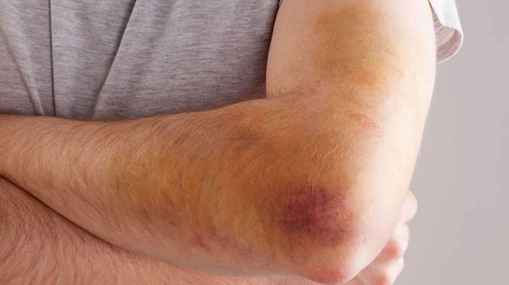 Pareja sufrió un robo piraña en el oeste de la ciudad