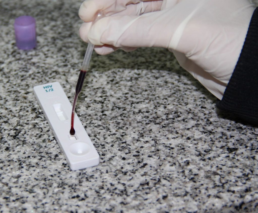 Impulsan una ley integral para prevenir y asistir casos de VIH, hepatitis virales, TBC e ITS