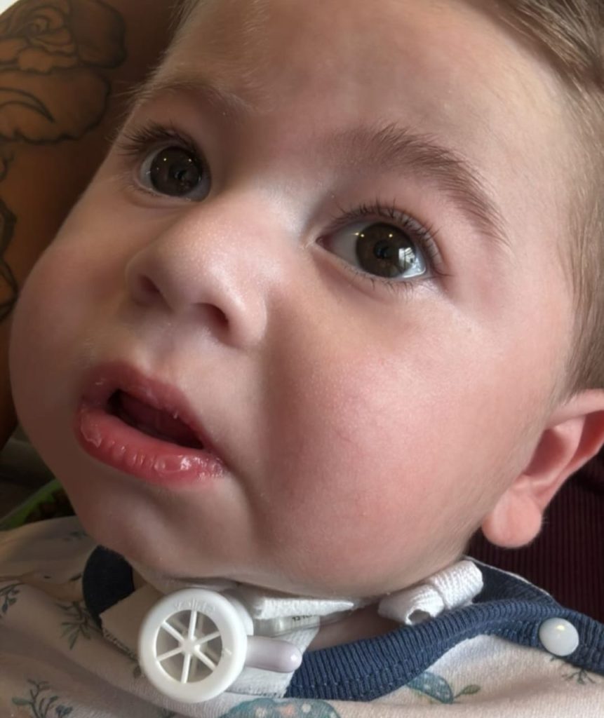 Felipe recupera su fuerza día a día mientras su familia sigue residiendo en Buenos Aires